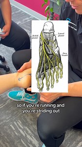 176 reactions · 22 shares | Treating the foot for knee pain?! Whaaat!...