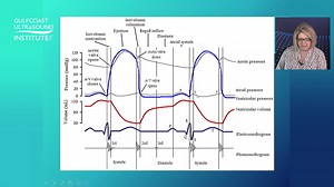 1.7K views · 33 shares | Explaining the Wiggers Diagram | Gulfcoast Ultrasound Institute, Inc. | Facebook