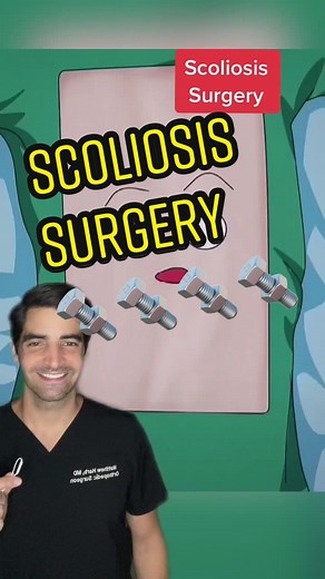Understanding Scoliosis Surgery: A Comprehensive Guide