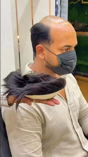 How to Do Hair Patch Self Service at Home 😱 Step-by-Step Guide #hairpatch #hairfixing