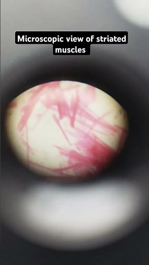 ||Microscopic view of striated muscles|| #microscope #specimens #anatomy #science #tissue