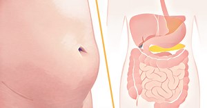 What Really Causes Bloating, And How Do You Prevent It?