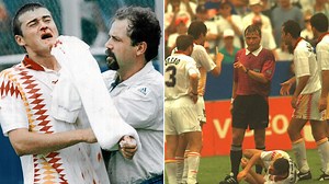 The 10 most shocking battle wounds in the history of football - MARCA in English