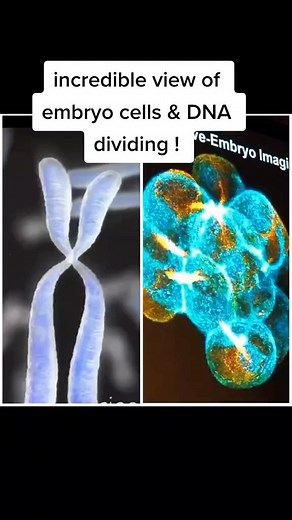 16K views · 48 reactions | mind blowing embryo video shows the actual chromosomes splitting and separating then the cells dividing previously only seen in animations #embryo #infertility #IVF #ttc #infertilitywarrior #ivfwarrior #infertilityjourney #Reels #reelsvideo #reelsviral #reelinstagram | Steven Palter | Facebook
