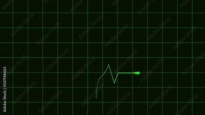 Heart rate monitor EKG line shows heartbeat with a graph of heart rhythm on black background.