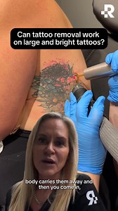 1.6K views | Think your big, bold, and colorful tattoo is impossible to remove? Think again. ✨ Our co-founder, Carmen, explains how advanced laser technology makes removal possible! | Removery | Facebook