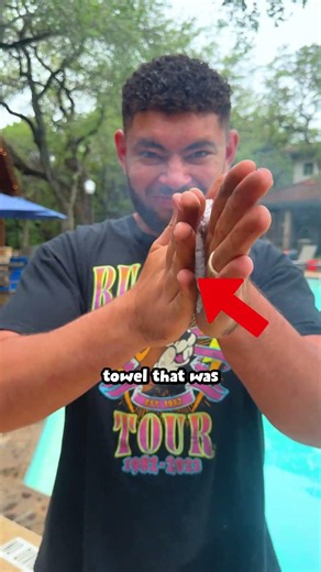 Part 2 of Accidentally Burning my Hand