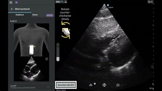 Vscan Air™ Product Tutorial | Caption AI™ | MDI Medical Ltd