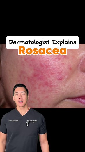 #rosacea #dermatologist #doctor #skintok #skincare #rosaceaawareness