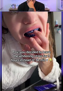 Stop Fake Teeth Whitening Scams! 😭🦷