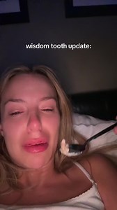 Wisdom Tooth Update: Tana Mongeau Wisdom Teeth Recovery Tips