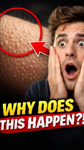 Why Your Skin Turns Into Chicken Skin 🐔 | The Crazy Truth About Goosebumps!