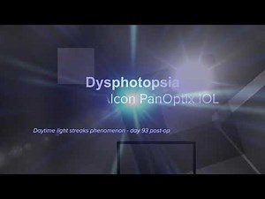 dysphotopsia - light streaks phenomenon