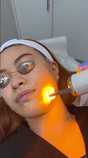 Advatx Laser Treatment - Ageless MD