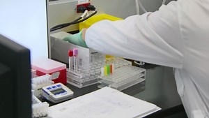 Staffing concerns in allied health professions