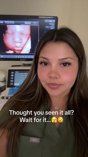 Real View Imaging of a Baby in 3D and 4D Ultrasound