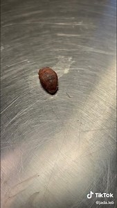 Botfly!🤢🤮#botfly #larva #removal