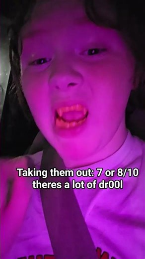 vampire teeth ratings!