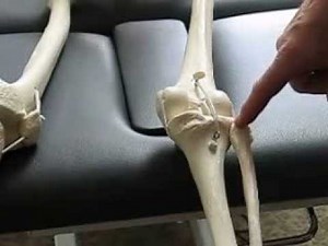 Part 1: Type 2 Cuboid Syndrome - Hesch Method Physical Therapy