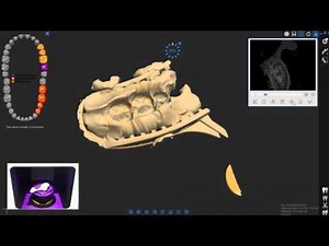 DOF Freedom HD - Dental Scanner (Impression)