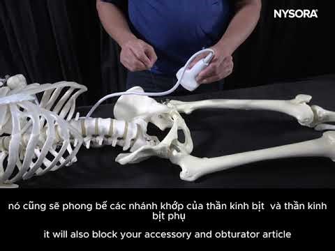 Phong bế nhóm thần kinh quanh bao khớp PENG block