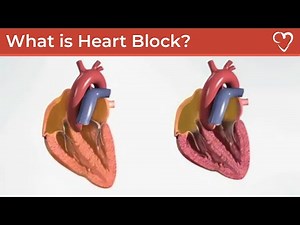 What is Heart Block?