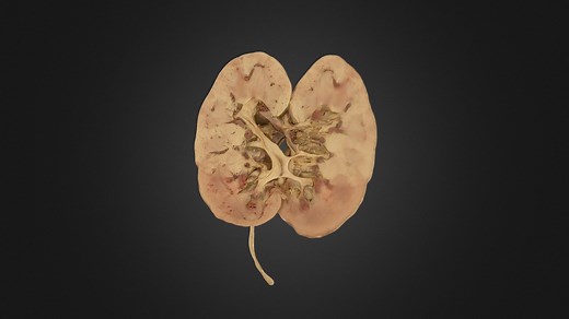 Bisected Human Kidney - 3D model by UBC Medicine - Educational Media