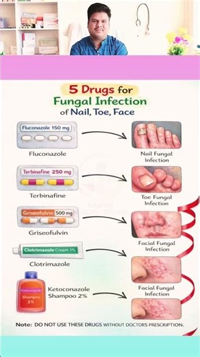 Most Commonly Used AntifungalMedicines |Fungal InfectionTreatmentExplained |
