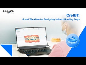 CreIBT: Smart Workflow for Designing Indirect Bonding Trays