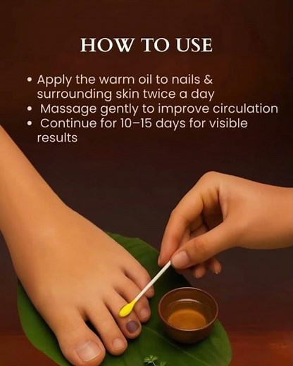 Say Goodbye to Nail Fungal Infections Naturally with Orga by Shazo’s