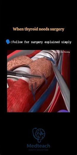 Thyroid Surgery Explained | Thyroidectomy in Simple Words #youtubeshorts #nursingstudents