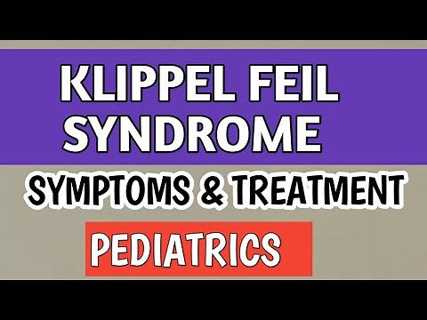 Klippel Feil Syndrome & Sprengel's Deformity In Children