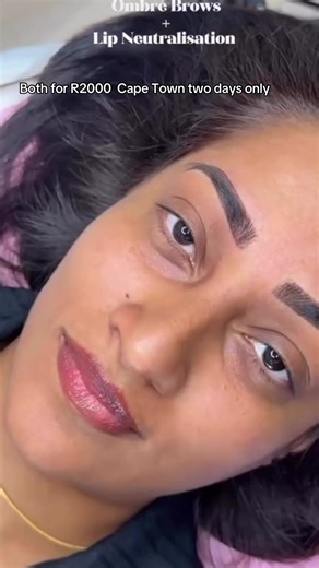 Everything You Need to Know About Lip Neutralisation