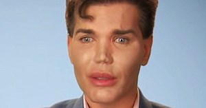 ‘Human Ken Doll’ Comes Out As Transgender & Quits Plastic Surgery