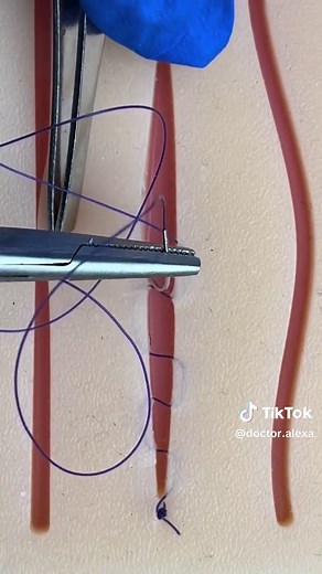 Mastering Surgical Skills: Essential Suture Techniques