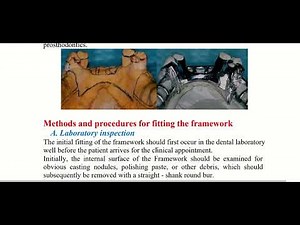 Fitting the removable partial denture framework