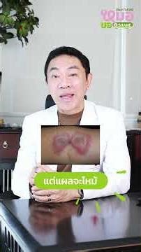 วิธีรักษาแมลงก้นกระดก