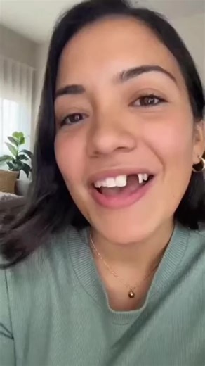 Diy my front tooth at home #thermal #frontteeth #faketeeth #moldablefalseteeth #brokentooth