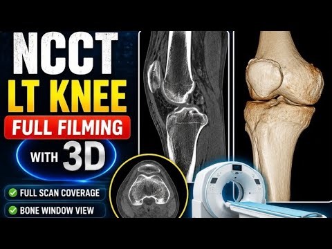 Ct Scan Lt Knee Full Filming // GE Machine