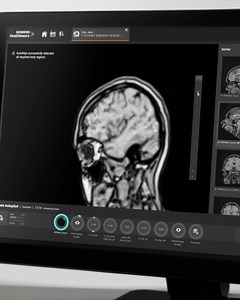 681K views · 1.3K reactions | Live webinar: learn from Indian peers and experts about a MRI system that breaks down the barriers of complex handling. | Siemens Healthineers | Facebook