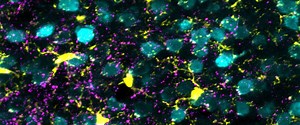 Dancing cells show how the brain awakens from anesthesia - Mayo Clinic News Network