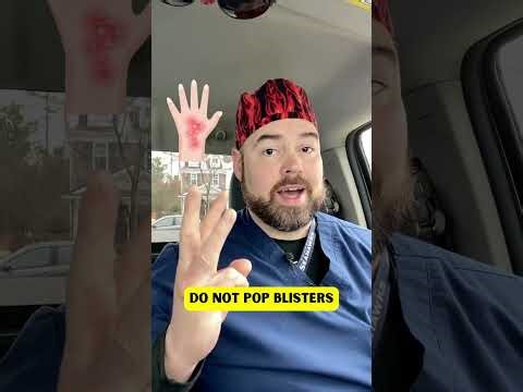 Frostbite Explained by a Nurse | Signs, Tissue Damage, and What NOT to Do