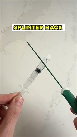 Remove Splinters PAINLESSLY with this trick! 🩹