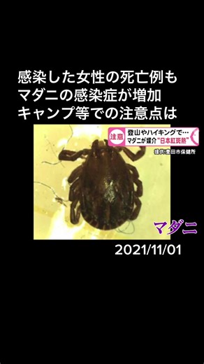 マダニが媒介する感染症「#日本紅斑熱 」の感染が愛知県豊田市の女性に先日確認されました。場合によっては死に至ることも…その対策を取材しました。#マダニ #感染症 #アウトドア #ハイキング #キャンプ #愛知 #ニュースOne #tiktokでニュース #11月1日