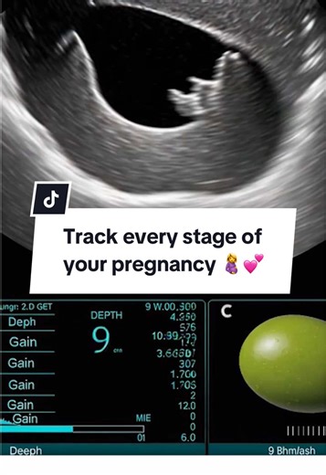 From conception to birth and beyond, Flo is here for every part of your pregnancy journey 🤰 #FloApp #PregnancyJourney #PregnantLife #FirstTimeMom #MomToBe