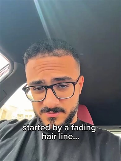 Struggling with bald spots or a receding hairline? Say goodbye to thinning hair and hello to a thicker,Our solution is your secret weapon for stopping hair shedding, reactivating dormant follicles, and restoring the hair you thought was gone forever.