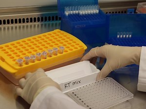 Streamlined Single Cell TCR Isolation and Generation of Retroviral Vectors for In Vitro and In Vivo Expression of Human TCRs