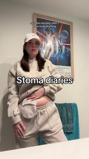 Stoma Diaries and Ostomy Awareness: Changing My Colostomy Bag