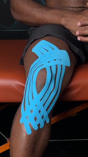 Taping For Knee Pain. Comment “Tape” Below To Unlock Our Masterclass. #kinesiotape #physiotherapy #kneepain #meniscus #physicaltherapy
