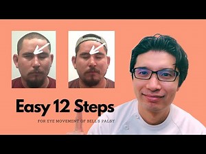 How To Make Your Blinking And Closing Your Eye Better For Bell’s Palsy